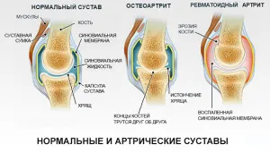 Відгуки про - be active - компресійний манжет для попереку і ніг