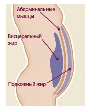 Плоский живіт вправи для преса, зробити живіт плоским, жир на животі прибрати складно