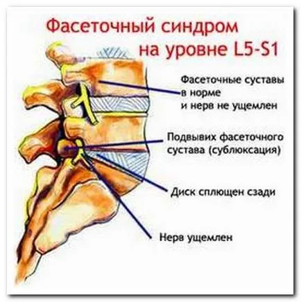 Чому болить в області спини і шиї (області) Чому болить в області спини і шиї
