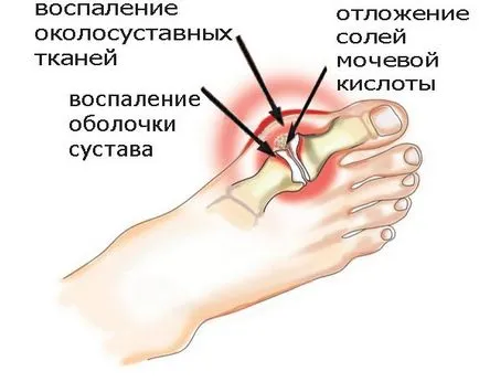Чому хрустять кістки