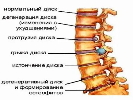 Хребет людини будова нумерація дисків (дисків) Хребет людини будова нумерація дисків