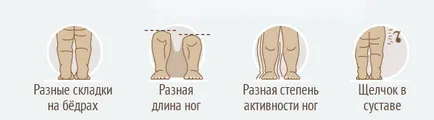 Правильне лікування дисплазії кульшового суглоба у дітей (дисплазії) Правильне лікування дисплазії кульшового суглоба у дітей