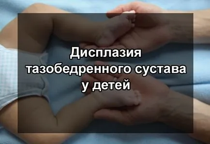 Правильне лікування дисплазії кульшового суглоба у дітей (дисплазії) Правильне лікування дисплазії кульшового суглоба у дітей