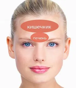 Прищі через кишечника (шлунка або печінки) (прищі) Прищі через кишечника (шлунка або печінки)