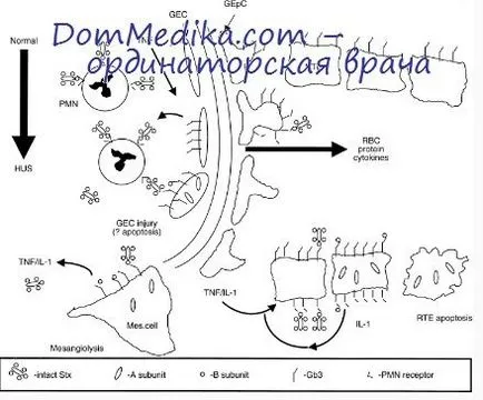 причини лихоманки