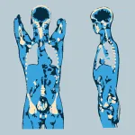 Radiant dicom viewer, ru