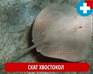 Якщо вас вколов скат - перша допомога (вколов) Якщо вас вколов скат - перша допомога