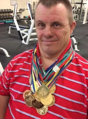 Синдром Дауна тривалість життя