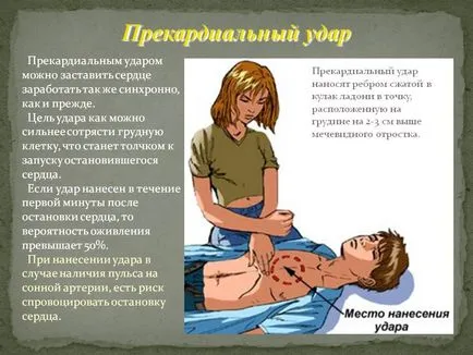 Синдром Морганьї-адамса-Стокса