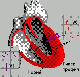 судинні препарати