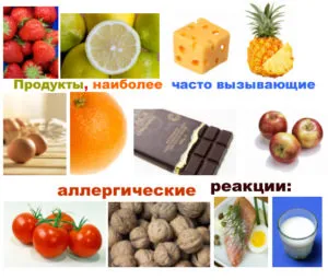 Засіб від харчової алергії - групи препаратів, народні засоби лікування, профілактика (алергії продукти прибрати раціону) Засіб від харчової алергії - групи препаратів, народні засоби лікування, профілактика