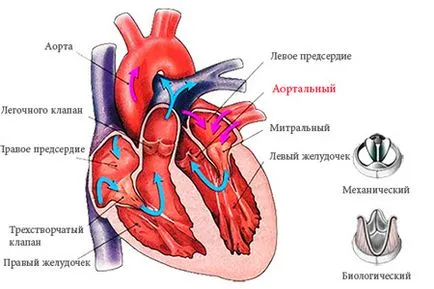 Стеноз аортального клапана симптоми, лікування (лікування) Стеноз аортального клапана симптоми, лікування