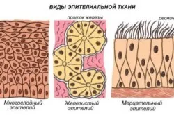 Свищ на п'ятій точці причини, симптоми, лікування і ускладнення - секрети здоров'я (свищ) Свищ на п'ятій точці причини, симптоми, лікування і ускладнення - секрети здоров'я