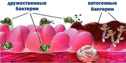 Свічки для відновлення мікрофлори піхви у жінок (мікрофлори) Свічки для відновлення мікрофлори піхви у жінок