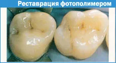 Техніка створення контактного пункту (створення) Техніка створення контактного пункту