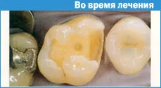 Техніка створення контактного пункту (пункту) Техніка створення контактного пункту