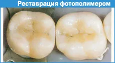 Техніка створення контактного пункту (техніка створення контактного пункту.) Техніка створення контактного пункту