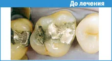 Техніка створення контактного пункту (контактного) Техніка створення контактного пункту