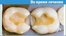 Техніка створення контактного пункту (техніка) Техніка створення контактного пункту