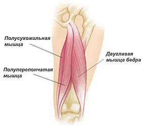 Травми м'яза стегна