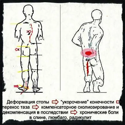 Травми спини при становій тязі що робити при болях в попереку (причини, симптоми і лікування) (спини) Травми спини при становій тязі що робити при болях в попереку (причини, симптоми і лікування)