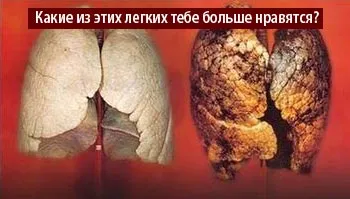 Важлива причина, щоб кинути палити - стаття на - pda версія (напої гуараной кофеїном) Важлива причина, щоб кинути палити - стаття на - pda версія