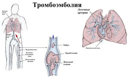 Вертельной перелом стегна причини, симптоми і лікування