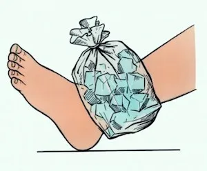 Вивих щиколотки лікування в домашніх умовах, лікування в домашніх умовах (умовах) Вивих щиколотки лікування в домашніх умовах, лікування в домашніх умовах