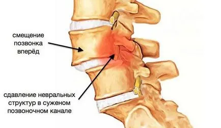 Виправлено хребців шийного, ш (працездатності внутрішніх органів) Виправлено хребців шийного, ш
