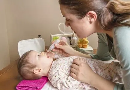Запалені аденоїди фото у дітей (дітей) Запалені аденоїди фото у дітей