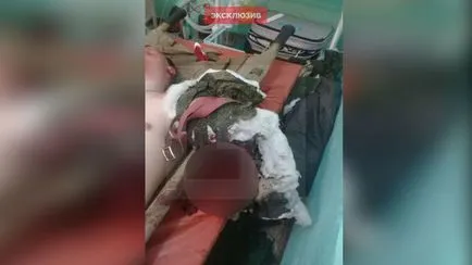 Будинок, який вибухнув в ак-74 патрон відірвав руку офіцерові на стрільбах міноборони (руку) Будинок, який вибухнув в ак-74 патрон відірвав руку офіцерові на стрільбах міноборони