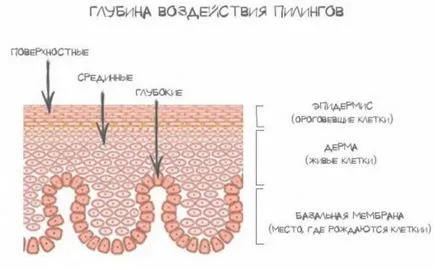Хімічний пілінг відгуки, наслідки, види пілінгів для обличчя, протипоказання (особи) Хімічний пілінг відгуки, наслідки, види пілінгів для обличчя, протипоказання