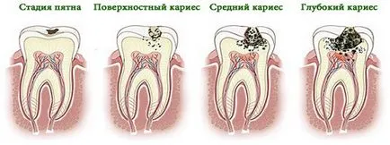 Захворювань зубів, ясен і народні засоби при зубному болю, правила здоров'я і довголіття (захворювання зубів і ясен) Захворювань зубів, ясен і народні засоби при зубному болю, правила здоров'я і довголіття