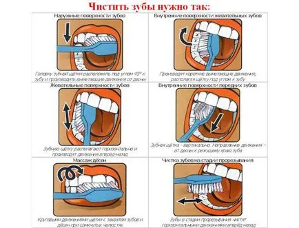 Захворювань зубів, ясен і народні засоби при зубному болю, правила здоров'я і довголіття (ясен) Захворювань зубів, ясен і народні засоби при зубному болю, правила здоров'я і довголіття