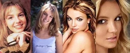 Зоряний ніс - зірки до і після ринопластики, жіночий журнал beewoman - мода, краса, відносини,