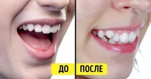 16 Самих цінних матеріалів планети
