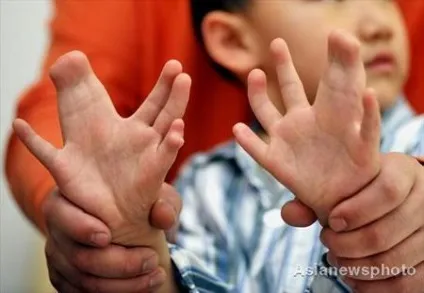 Генна мутація, як відбувається мутація світ ДНК - біотехнології майбутнього (генна мутація відбувається) Генна мутація, як відбувається мутація світ ДНК - біотехнології майбутнього