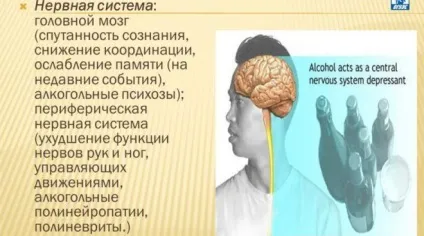 Аденома гіпофіза - симптоми пухлини у жінок і лікування, наслідки (гіпофіза) Аденома гіпофіза - симптоми пухлини у жінок і лікування, наслідки