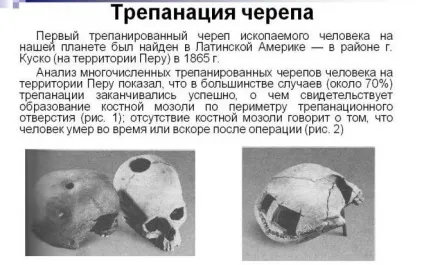 Аденома гіпофіза - симптоми пухлини у жінок і лікування, наслідки (аденома) Аденома гіпофіза - симптоми пухлини у жінок і лікування, наслідки