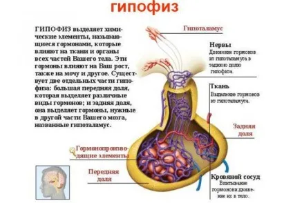 Аденома гіпофіза - симптоми пухлини у жінок і лікування, наслідки (симптоми) Аденома гіпофіза - симптоми пухлини у жінок і лікування, наслідки