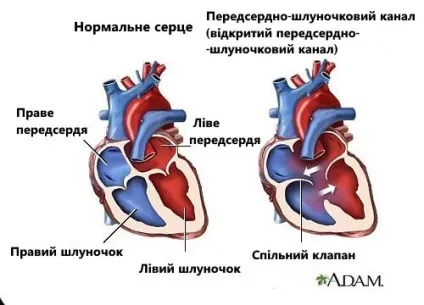 7 Симптомів шумів серця, про які слід знати