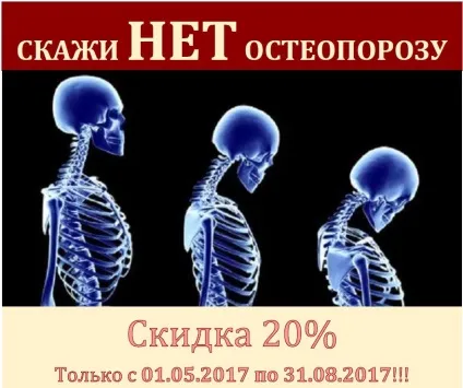 Акція на програму з діагностики остеопорозу (програму) Акція на програму з діагностики остеопорозу