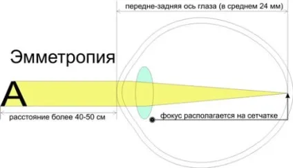 Аномалія рефракції ока їх корекція