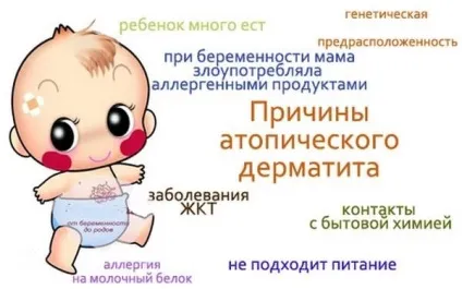 Атопічний дерматит у дітей причини появи, лікування, симптоми