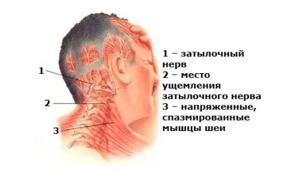Болить голова в потилиці причини і що робити - настройка здоров'я (причини) Болить голова в потилиці причини і що робити - настройка здоров'я