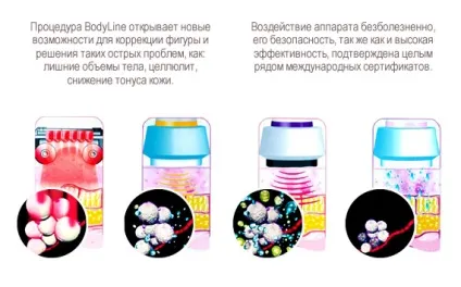 Bodyline в москві, ціни і відгуки - клініка лантан (ліпосакція подарунковий сертифікат кавитация кріотерапія биоревитализация апаратна косметологія схуднення без дієт безоперационная ліпосакція лікування целюліту безоперационная підтяжка обличчя термоліфтінга) Bodyline в москві, ціни і відгуки - клініка лантан