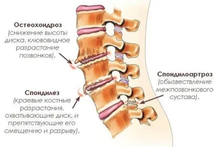 Болить голова в потилиці причини і що робити - настройка здоров'я (болить) Болить голова в потилиці причини і що робити - настройка здоров'я