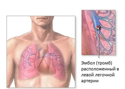 Болить ліва груди у жінок - що це значить причини болю і дискомфорту (ліва) Болить ліва груди у жінок - що це значить причини болю і дискомфорту