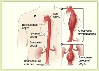 Болить ліва груди у жінок - що це значить причини болю і дискомфорту (груди) Болить ліва груди у жінок - що це значить причини болю і дискомфорту