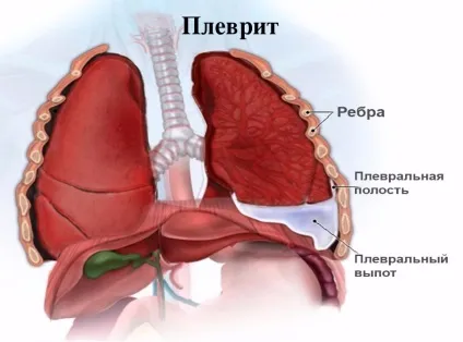 Болить ліва груди у жінок - що це значить причини болю і дискомфорту (причини) Болить ліва груди у жінок - що це значить причини болю і дискомфорту